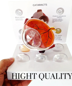 Alternative view of Alat Peraga Anatomi Bola Mata Manusia Katarak Human Anatomy Cataract Eye Model