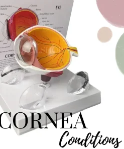 Alat Peraga Model Anatomi Bola Mata Manusia Cornea Human Anatomy