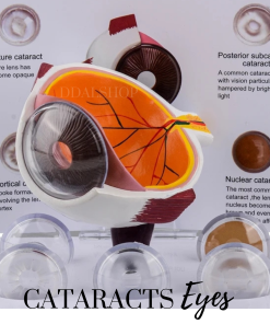 Alat Peraga Model Anatomi Bola Mata Manusia Cornea Human Anatomy