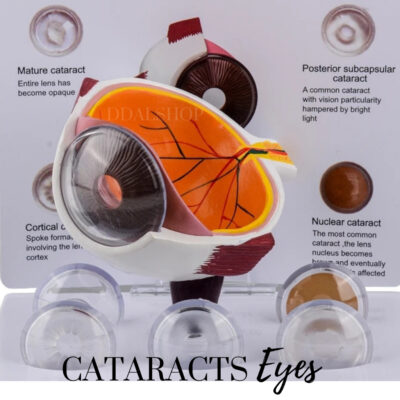 Alat Peraga Anatomi Bola Mata Manusia Katarak Human Anatomy Cataract Eye Model - Foto 1