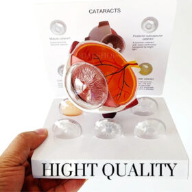 Alat Peraga Anatomi Bola Mata Manusia Katarak Human Anatomy Cataract Eye Model - Foto 7